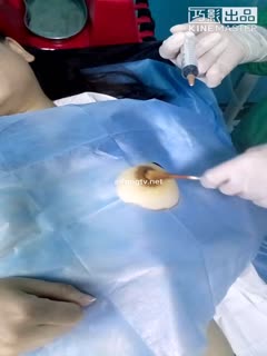 高价收购少妇到地下私人无证经营的美容院做丰胸美容手术被偷拍对白清晰 海报